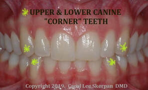 canine teeth long