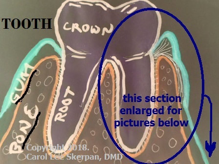 Drawn picture from last blog outlining section of crown & root enlarged for below pictures