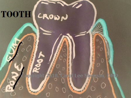 Drawn image of the a Tooth with the crown,root, gum & bone labelled